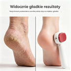 Dwustronny pilnik do stóp umożliwiający łatwe usuwanie odcisków.
